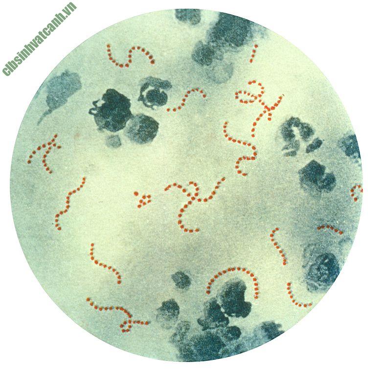 Vi khuẩn Streptococcus pyogenes - clbsinhvatcanh.vn